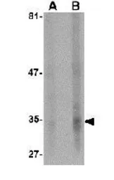 Anti-EndoG antibody [7F2G10] used in Western Blot (WB). GTX84985