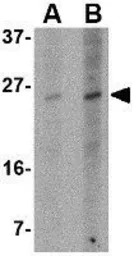 Anti-PUMA antibody [10D4G7] used in Western Blot (WB). GTX84989