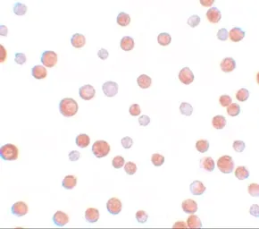 Anti-TCF12 antibody used in Immunocytochemistry/ Immunofluorescence (ICC/IF). GTX84997