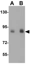 Anti-DCLK1 antibody used in Western Blot (WB). GTX85008