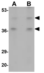 Anti-BFAR antibody used in Western Blot (WB). GTX85010