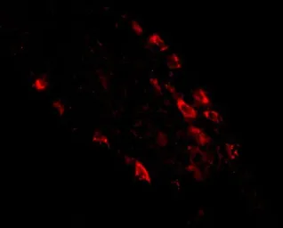 Anti-MEX3D antibody used in IHC (Paraffin sections) (IHC-P). GTX85026
