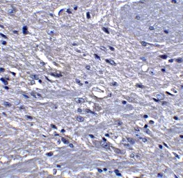 Anti-GPAM antibody used in IHC (Paraffin sections) (IHC-P). GTX85034