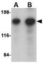 Anti-CAPS1 antibody used in Western Blot (WB). GTX85036