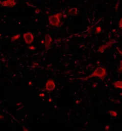 Anti-CAPS1 antibody used in IHC (Paraffin sections) (IHC-P). GTX85037