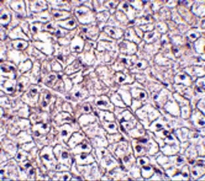 Anti-CRLF2 antibody used in IHC (Paraffin sections) (IHC-P). GTX85052