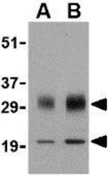 Anti-SCO1 antibody used in Western Blot (WB). GTX85056