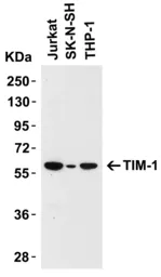 Anti-TIM-1 antibody used in Western Blot (WB). GTX85067