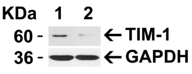 Anti-TIM-1 antibody used in Western Blot (WB). GTX85067