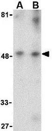 Anti-TIM-1 antibody used in Western Blot (WB). GTX85067