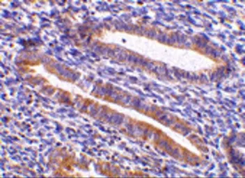 Anti-TIM-1 antibody used in IHC (Paraffin sections) (IHC-P). GTX85068