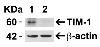 Anti-TIM-1 antibody used in Western Blot (WB). GTX85068