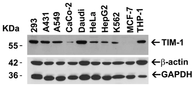 Anti-TIM-1 antibody used in Western Blot (WB). GTX85068
