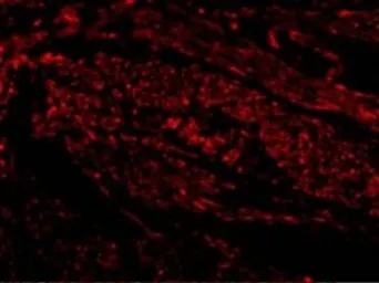 Anti-TIM-1 antibody used in IHC (Paraffin sections) (IHC-P). GTX85068