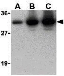 Anti-CTRP2 antibody used in Western Blot (WB). GTX85071