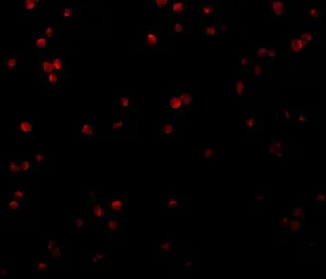 Anti-CTRP2 antibody used in Immunocytochemistry/ Immunofluorescence (ICC/IF). GTX85071