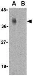 Anti-CTRP2 antibody used in Western Blot (WB). GTX85077