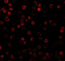 Anti-DAD1 antibody used in Immunocytochemistry/ Immunofluorescence (ICC/IF). GTX85083