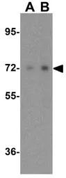Anti-Raf1 antibody used in Western Blot (WB). GTX85101