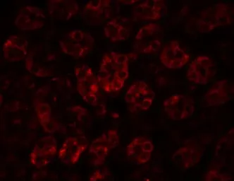 Anti-ENC1 antibody used in IHC (Paraffin sections) (IHC-P). GTX85108