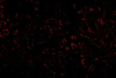 Anti-LDL Receptor antibody used in IHC (Paraffin sections) (IHC-P). GTX85109
