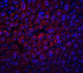 Anti-Albumin antibody used in IHC (Paraffin sections) (IHC-P). GTX85111