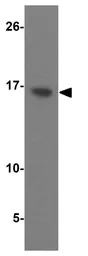 Anti-Prealbumin antibody used in Western Blot (WB). GTX85112