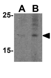 Anti-Prealbumin antibody used in Western Blot (WB). GTX85112