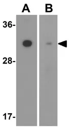 Anti-SLC39A2 antibody used in Western Blot (WB). GTX85134
