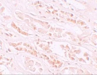 Anti-EFCAB4B antibody used in IHC (Paraffin sections) (IHC-P). GTX85142