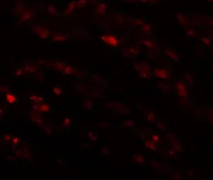 Anti-EFCAB4B antibody used in IHC (Paraffin sections) (IHC-P). GTX85142