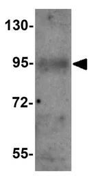 Anti-EFCAB4B antibody used in Western Blot (WB). GTX85142