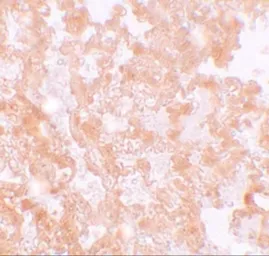 Anti-MFSD2A antibody used in IHC (Paraffin sections) (IHC-P). GTX85147