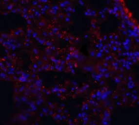 Anti-MFSD2A antibody used in IHC (Paraffin sections) (IHC-P). GTX85147
