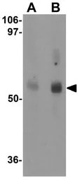 Anti-MFSD2A antibody used in Western Blot (WB). GTX85147