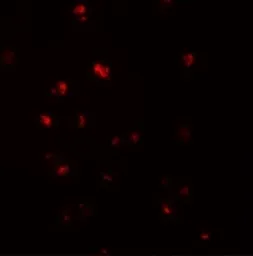 Anti-NOD4 antibody used in Immunocytochemistry/ Immunofluorescence (ICC/IF). GTX85160