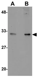 Anti-ALKBH2 antibody used in Western Blot (WB). GTX85166