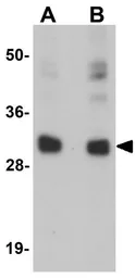 Anti-CCDC106 antibody used in Western Blot (WB). GTX85167