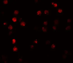 Anti-ATP11A antibody used in Immunocytochemistry/ Immunofluorescence (ICC/IF). GTX85170