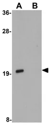 Anti-APC13 antibody used in Western Blot (WB). GTX85186