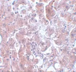 Anti-ELOVL7 antibody used in IHC (Paraffin sections) (IHC-P). GTX85201