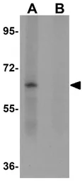 Anti-ZSCAN4 antibody used in Western Blot (WB). GTX85205