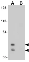 Anti-CALM antibody used in Western Blot (WB). GTX85213