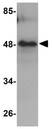 Anti-RHBDD3 antibody used in Western Blot (WB). GTX85218