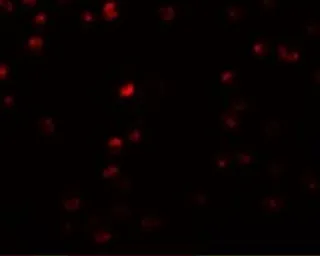 Anti-OCIAD2 antibody used in Immunocytochemistry/ Immunofluorescence (ICC/IF). GTX85233
