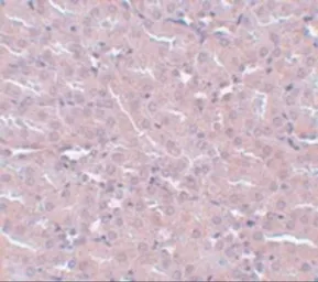 Anti-FRMPD2 antibody used in IHC (Paraffin sections) (IHC-P). GTX85236