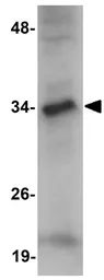 Anti-JMJD7 antibody used in Western Blot (WB). GTX85250