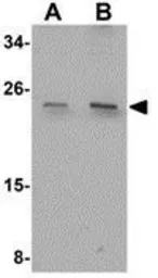 Anti-CCDC134 antibody used in Western Blot (WB). GTX85268