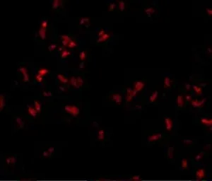 Anti-SCARA5 antibody used in Immunocytochemistry/ Immunofluorescence (ICC/IF). GTX85270