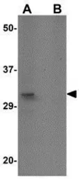 Anti-THEM2 antibody used in Western Blot (WB). GTX85271